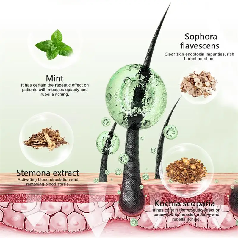 كريم إزالة حب الشباب للجسم علاج الوجه بعقب الظهر علامات حب الشباب إصلاح سلس كريم جلد الدجاج ترطيب تبييض العناية بالبشرة