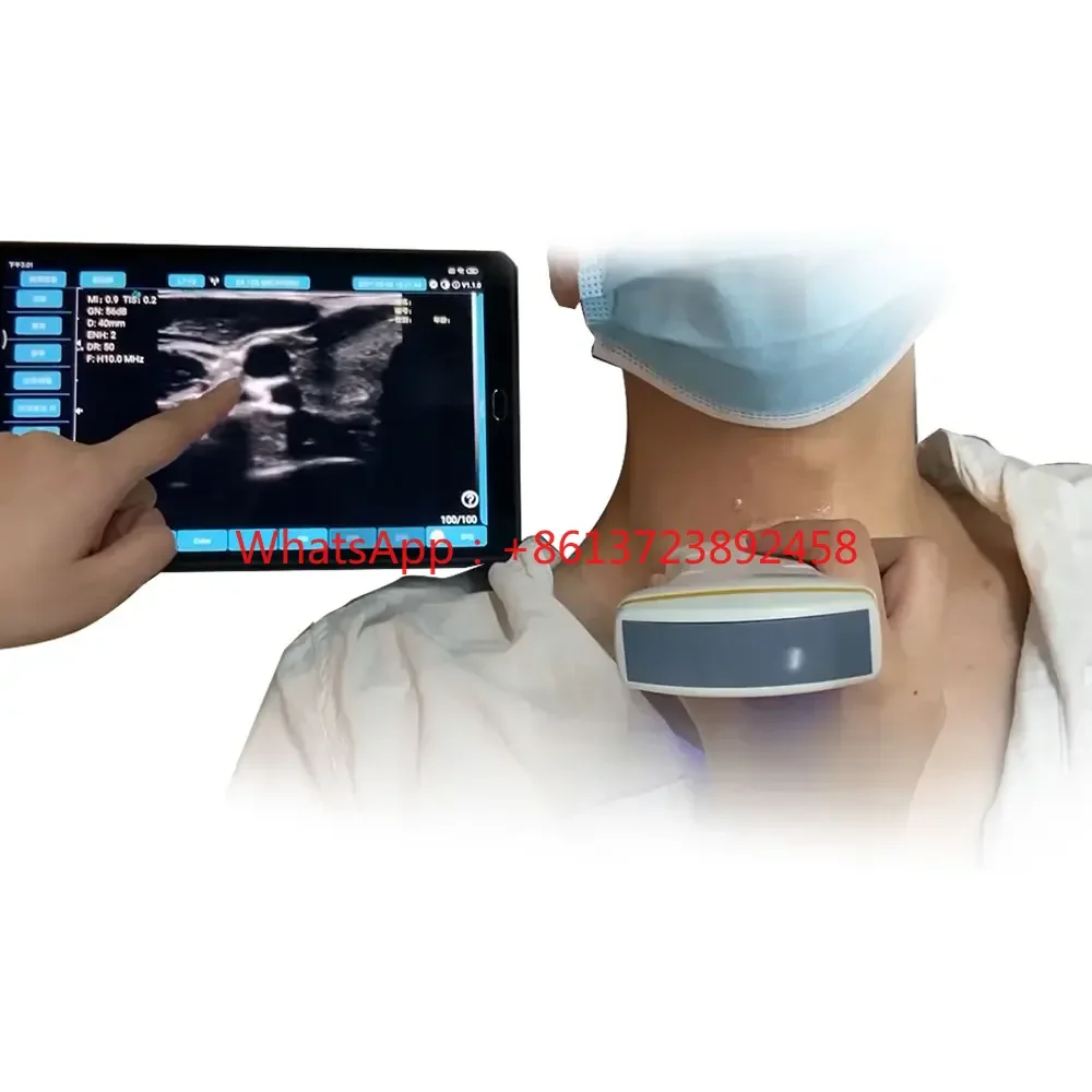 

Portable Doppler Ultrasound Convex and Linear Wireless Ultrasound Scanner Double Head Wireless Ultrasound Probe Electric