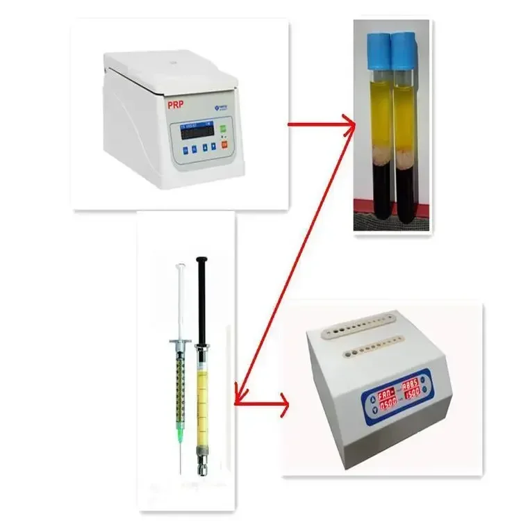 High quality PRP Heating cooling ppp plasma Gel maker Portable bio filler machine