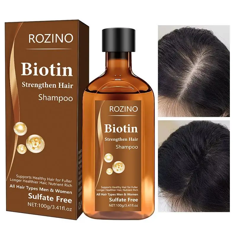ビオチンヘアシャンプー増毛強化根オイルコントロールヘアボリュームシャンプービオチンヘア血清 30 ミリリットル/100 グラムヘアケア