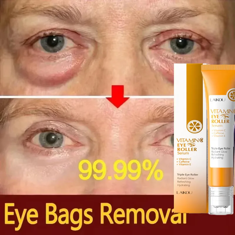 

Eye Serum Eye Bag Removal Cream Vitamin C Anti Dark Circle Puffiness Fade Fine Lines Anti-Wrinkle Firming Brighten Eye Care Gel