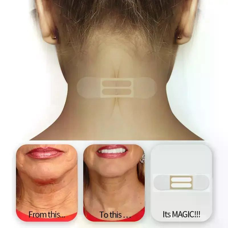 

10 шт., пластыри для подтяжки шеи, водонепроницаемые, эластичные, невидимые, выцветающие, клейкие наклейки для морщин, ленты для подтяжки лица, эластичные ленты