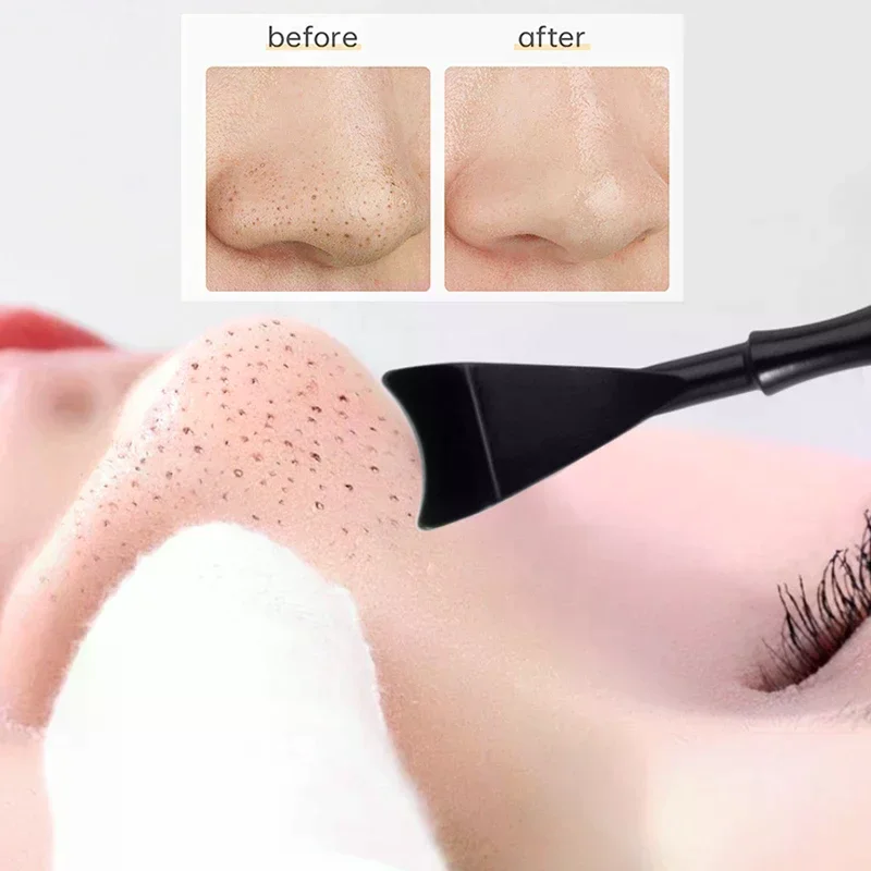 2 In 1 Brufolo Popper Strumento Rimozione di Comedone Acne Ago Rimozione Trattamento Punti Bianchi Popping Zit Naso Viso Estrattore di imperfezioni