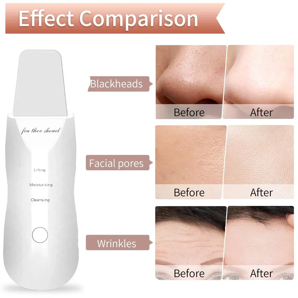 Raspador de pele elétrico peeling removedor de cravo ultra-sônico limpeza profunda do rosto levantamento acne poros espátula facial pá limpador