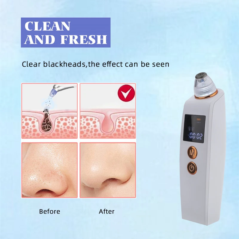 Blackhead Remover Diamond Dermabrasion Nose Vacuum Pore Cleanser Acne Pimple Suction Extractor USB Rechargeable Skin Care Tool