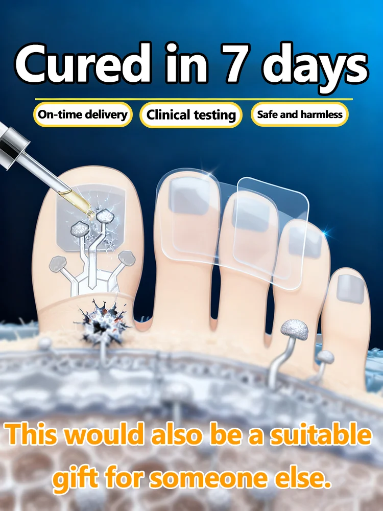 

Уход за ногами: представление красоты в деталях! Блокировка инфекции и лечение uickly