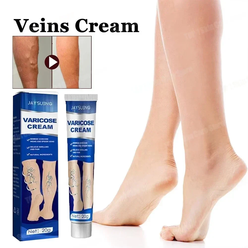 Improvement of moderate varicose veins, relief of pain, and improvement of blood circulation