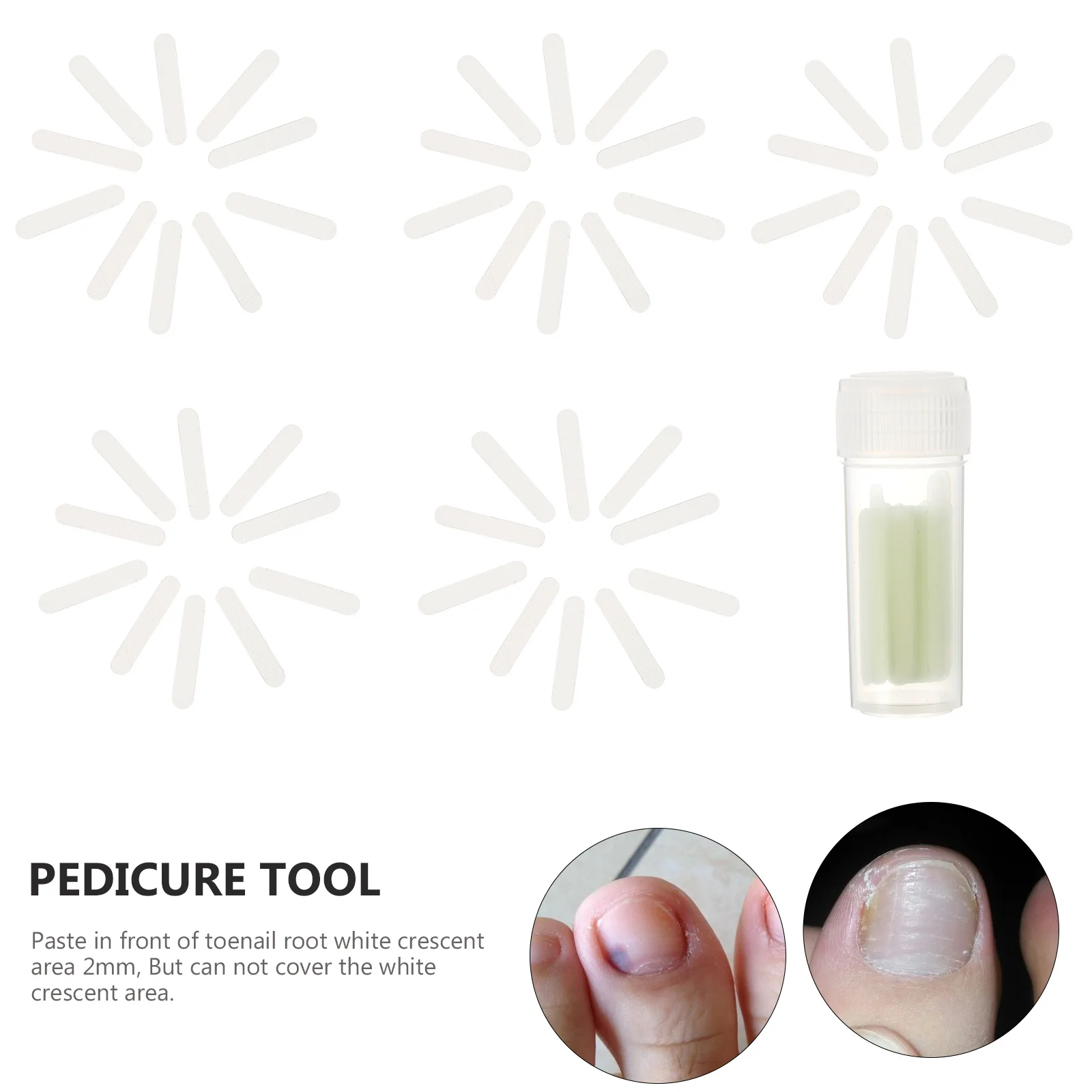 

50pcs Ingrown Toenail Corrector Strips Paronychia Treatment Tape For Toenail Correction Clip Curved Toenails Recovery Tool