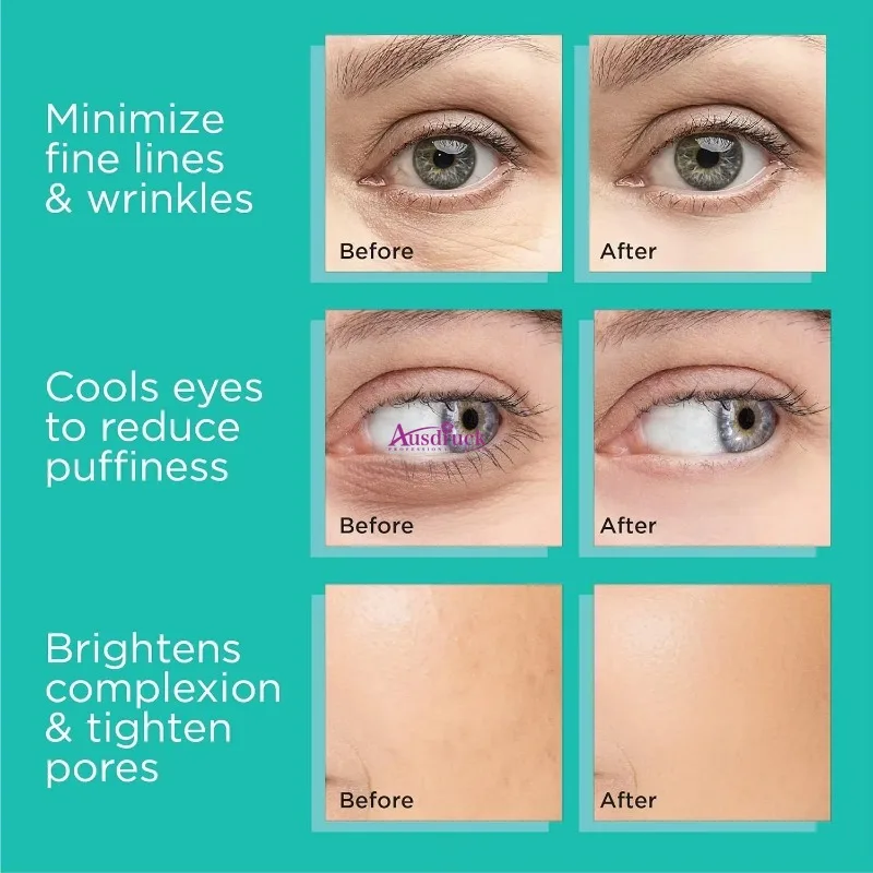 كرات ثلج صغيرة من الفولاذ المقاوم للصدأ، أداة تبريد الوجه والعيون، أداة العناية ببشرة الوجه، تقليل الانتفاخ #5