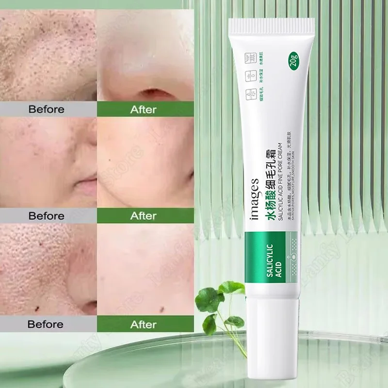 Salicylic Acid Pore Clearing Cream Shrink Pores Remove Blackheads Acne Brighten Moisturizing Smooth Skin Care Korean Products