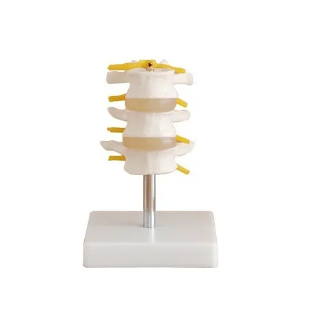 3-Segment Lumbar Spine Skeleton Model Lesions Intervertebral Disc Skeleton Spine Medical Model Teaching Aid Education