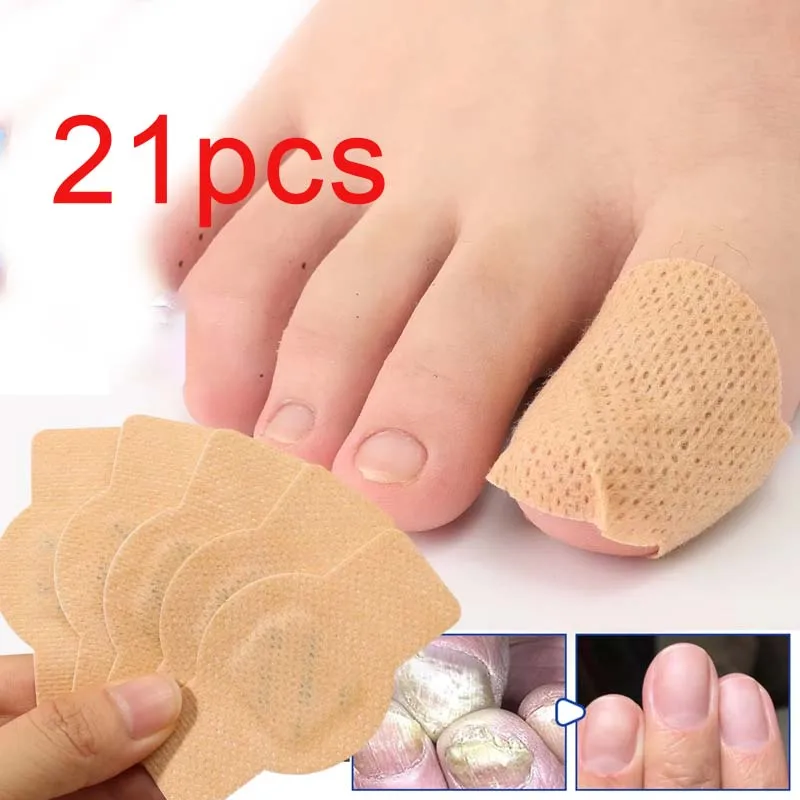 Nail Fungus Patch Waterproof Nail Repair Patch Ingrown Correction Sticker Damaged Nail Gray Care Patch Feet Care Tools