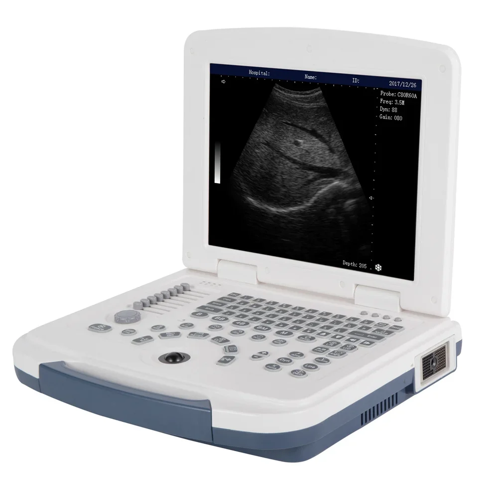 

High quality B-mode ultrasonography Device Laptop BW Ultrasound diagnostic system
