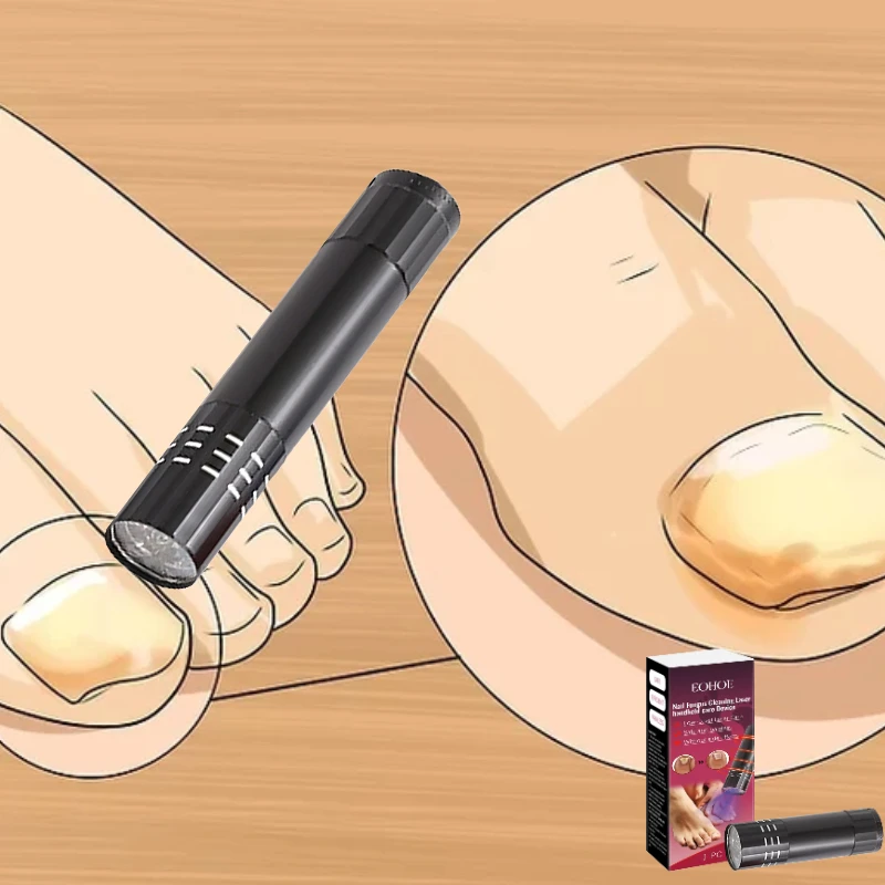 

Ragged Cuticles & Cracking Nail Edges， Laser Repair Pen Repairs, Makes Fingertips Smoother