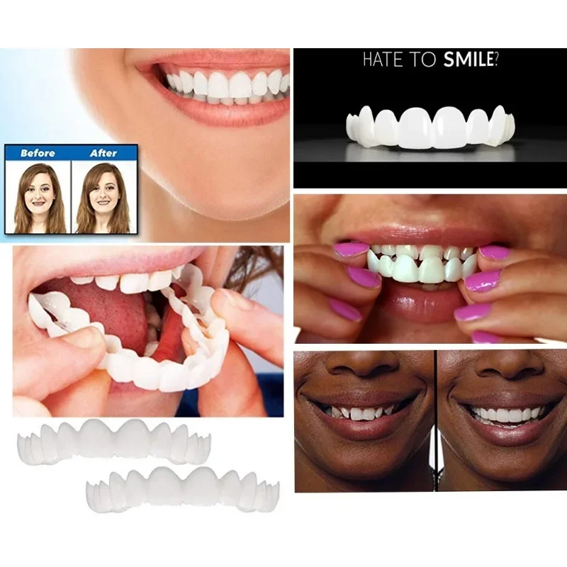 

New Sdottor Upper & Lower Teeth Veneers Anti-true Braces Snap On Smile Teeth Whitening Denture Teeth Comfortable Veneer Cover T