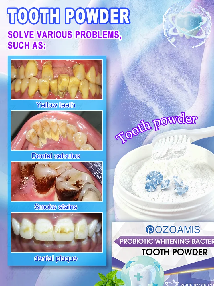 Probiotic ᴡʜɪᴛᴇɴɪɴɢ ᴛᴏᴏᴛʜ powder: Rᴇᴍᴏᴠᴇs ᴛᴀʀᴛᴀʀ and eliminates bad ʙʀᴇᴀᴛʜ