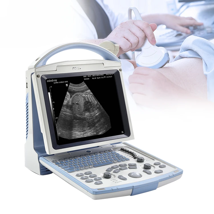 Ultrasound Full Digital Ultrasonic Diagnostic Imaging System B/W Portable  Machine