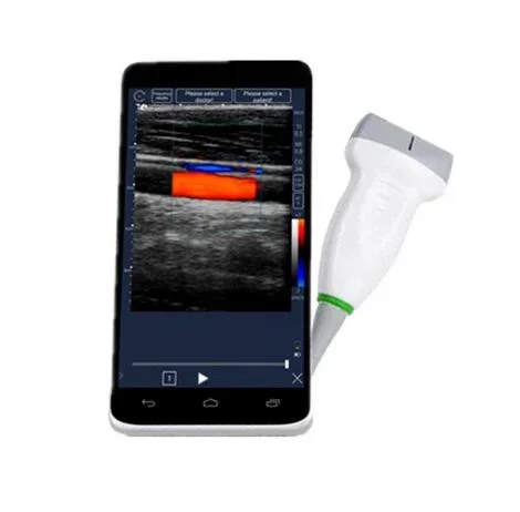 Handheld ultrasound machine linear mini portable ultrasound device ultrasound machine for smartphone