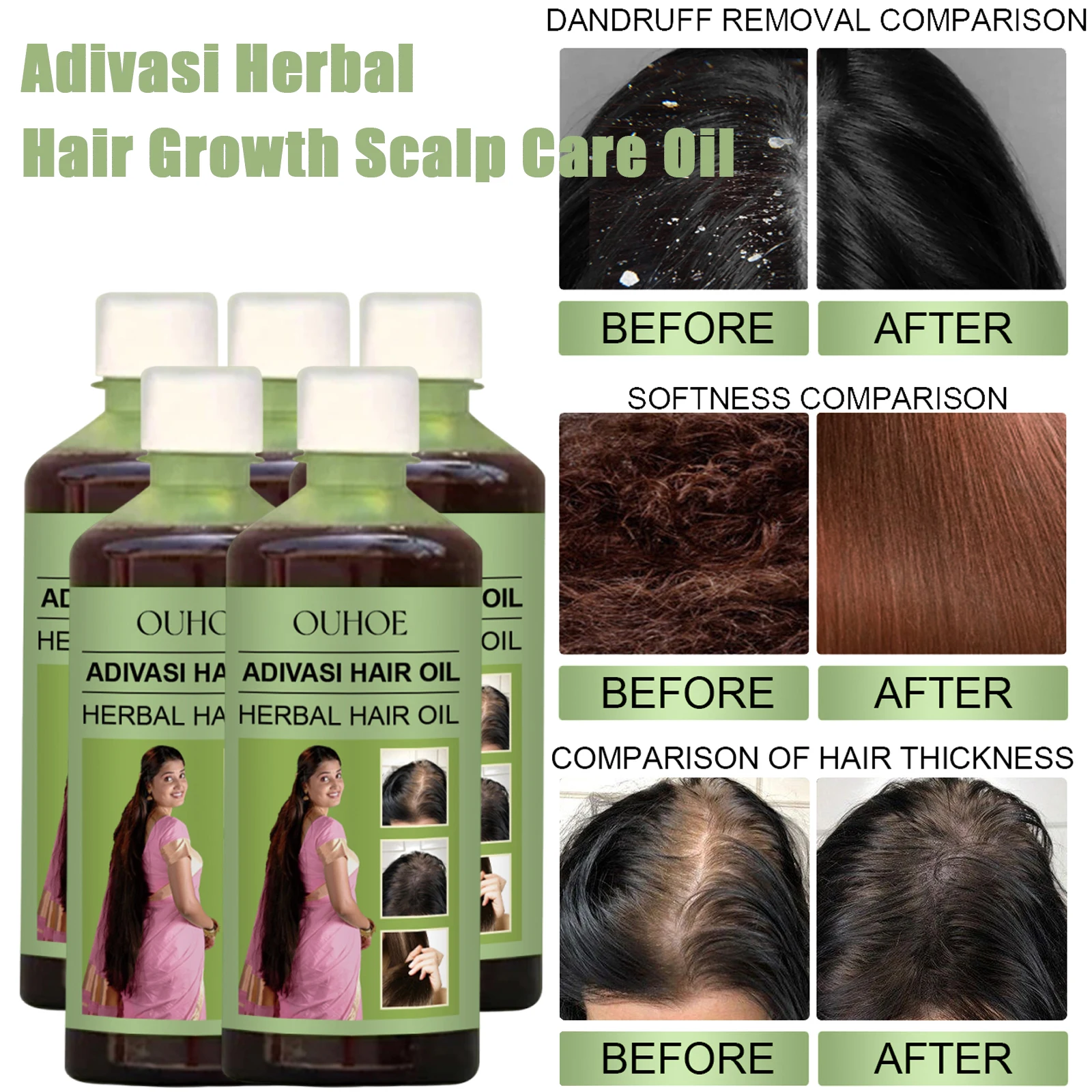 

100ml Hair Growth Oil India Adivasi Herbal Hair Care Rosemary Repair Damaged Hydrate Moisturize Scalp Reduce Dandruff