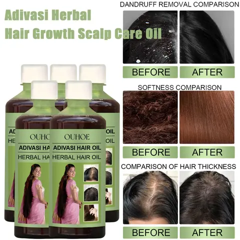 100ml Hair Growth Oil India Adivasi Herbal Hair Care Rosemary Repair Damaged Hydrate Moisturize Scalp Reduce Dandruff