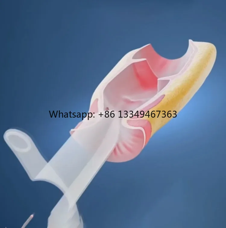 White C Model Anoscope Disposable Proctoscopy for Treatment of Hemorrhoids Anal Dilator Half Cut