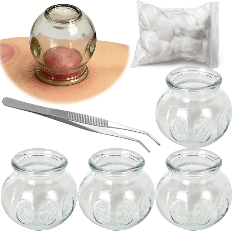 

Набор для баночной терапии из 4 предметов: стеклянные массажные банки для вакуумного массажа