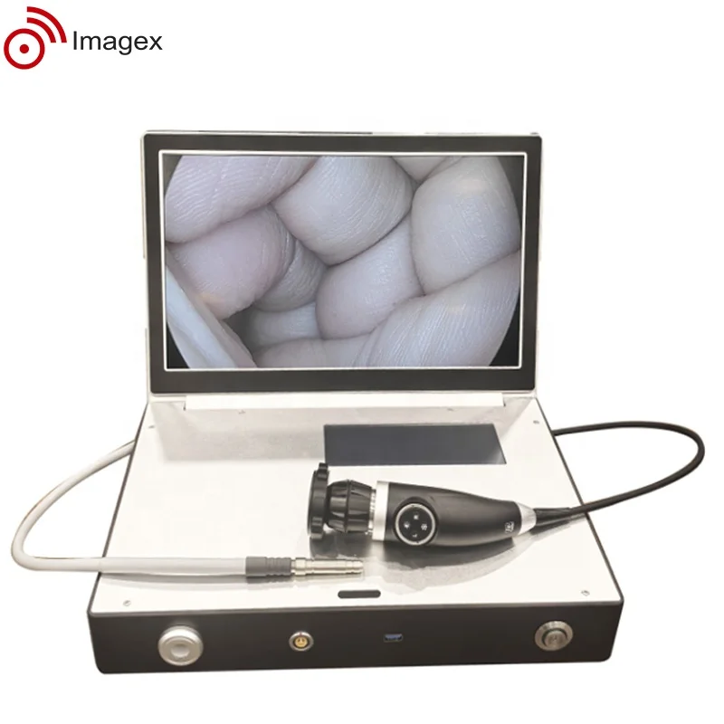 15.6 Inch All in One Endoscope Camera System for Veterinary ENT Procedures