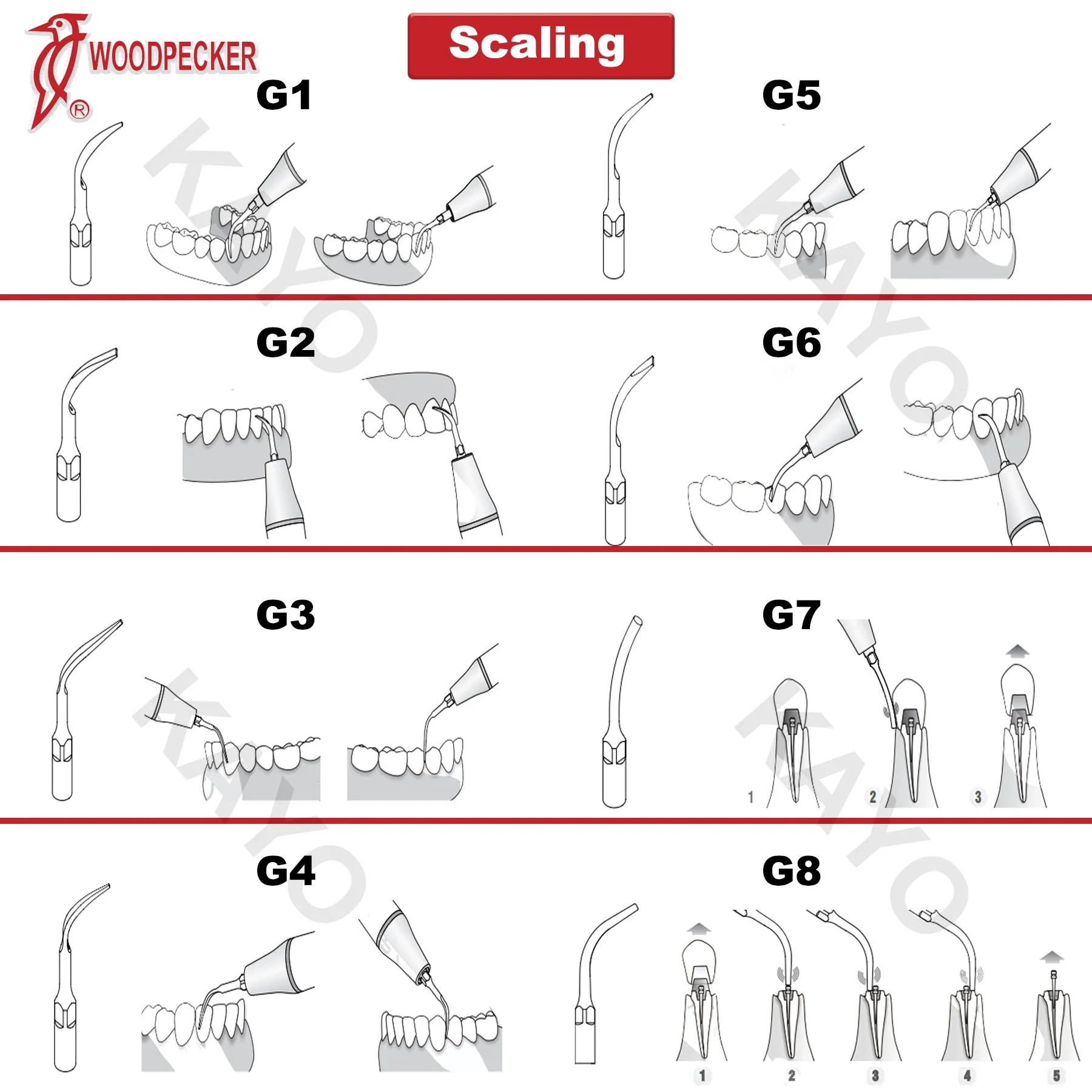 

Woodpecker G-SERIES Ultrasonic Scaler Tips - 100% Original for EMS UDS-L Handpieces - Dental Cavity Prep & Scaling Inserts
