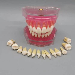 Dental Adult Extractable Teeth Standard Model M7008 Oral Teaching Model Full Mouth Teeth Removable Dental Materials