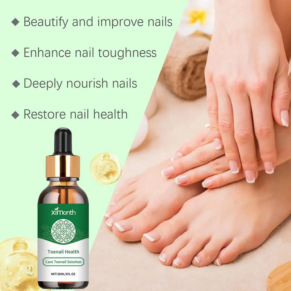 Nail Fungal Treatment Essence Oil, Foot Toe Nail, Soro de remoção de fungos, Reparação Onicomicose, Gel Anti Infecção, Produtos para o cuidado, 30ml