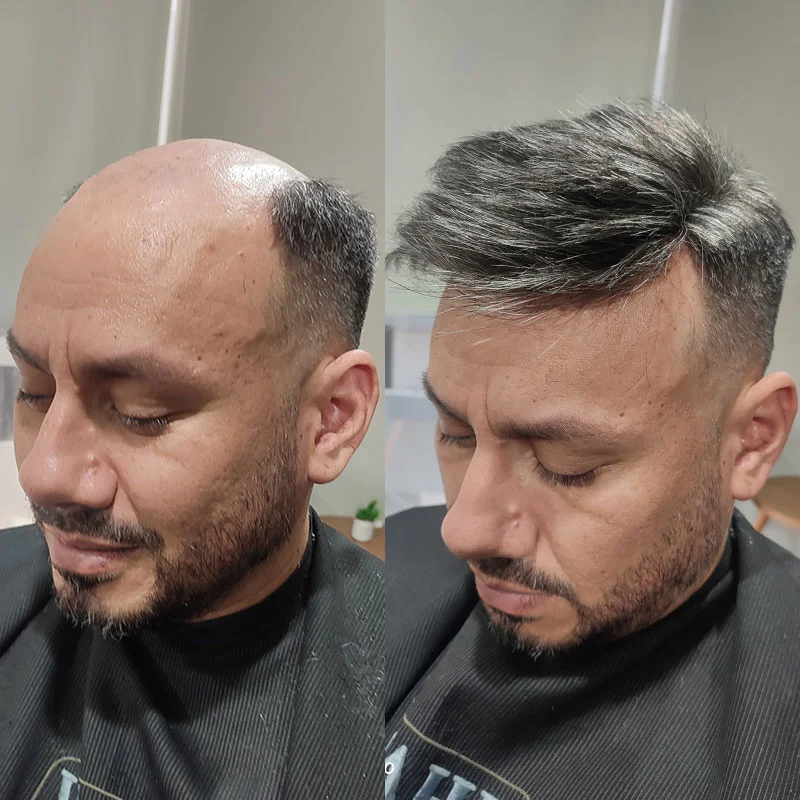 Prótese de cabelo masculino suíço, peruca frontal de renda com pele durável com nó nas costas, peruca para homens, sistema de cabelo 100% humano para homens