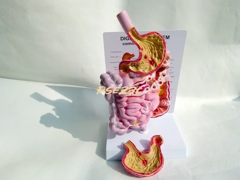 Adult Human Digestive System Large Intestine Model Duodenal Visceral Gastrointestinal Medical Anatomical Model