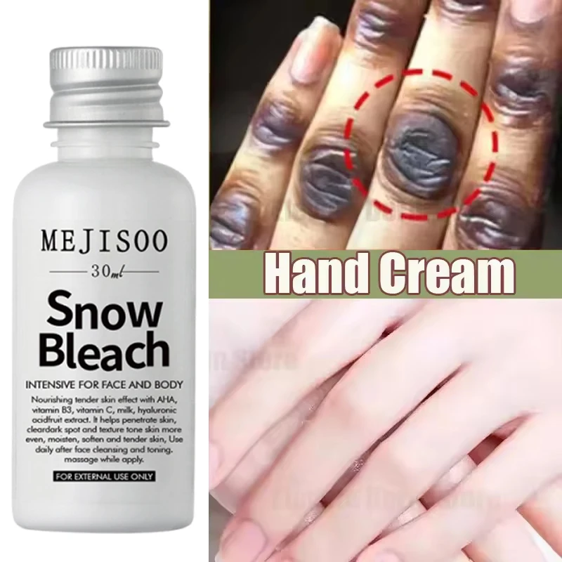تبييض سريع المفاصل الداكنة سطع كريم اليد الميلانين مصحح ترطيب البقع المكثفة مزيل المنتجات العناية بالبشرة الكورية