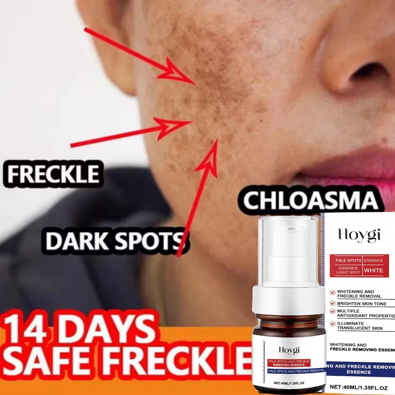 

Powerful Spot-removing Whiten Serum Cream Vitamin C Skin Brighten Essence Removal Melasma Dark Spots Moisturize Beauty Skin Care