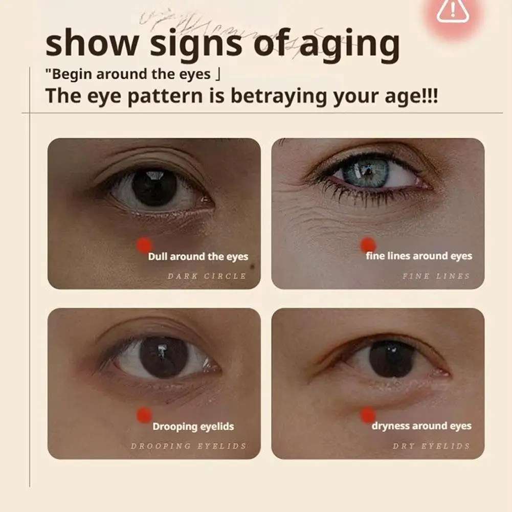 30 g Osiyun Kräuter-Straffungs-Augencreme, entfernen Tränensäcke, reduzieren feine Linien, Augenringe, bleibende Late-Augencreme 1–3 Stück