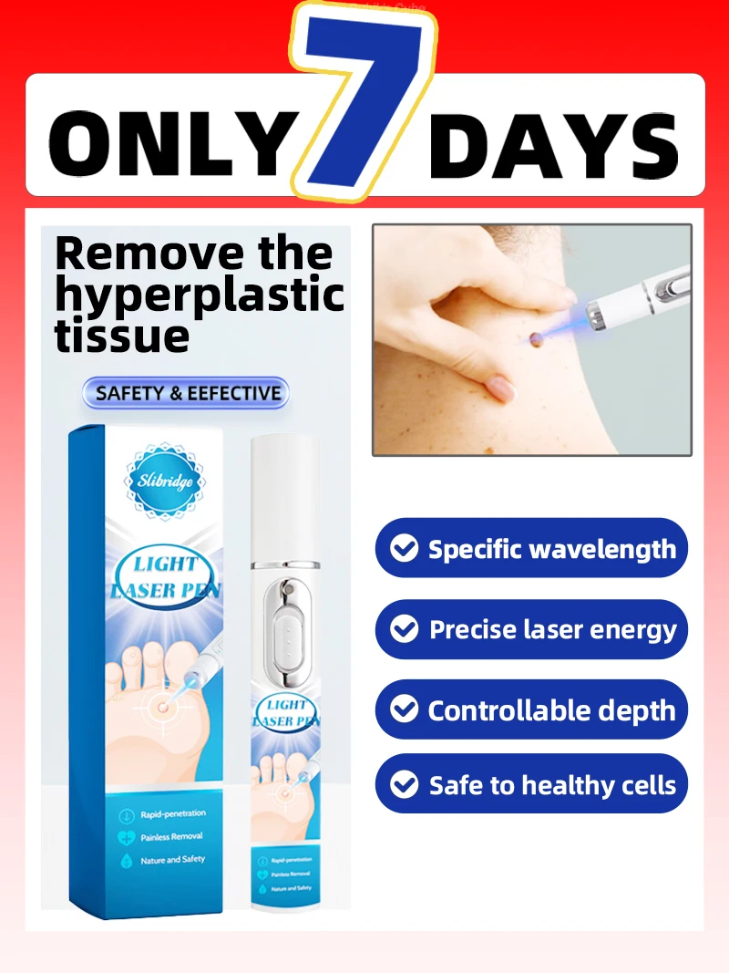 3세대 레이저는 7일 만에 사마귀와 작별을 이합니다