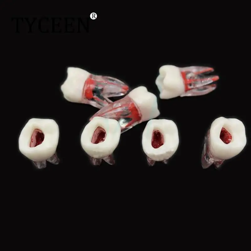 1Pc Dental model zęba kanał korzeniowy RCT praktyka miazga jamy wyczyść żywica nauczanie model zębów 1:1 Model dentystyczny dentysta narzędzia