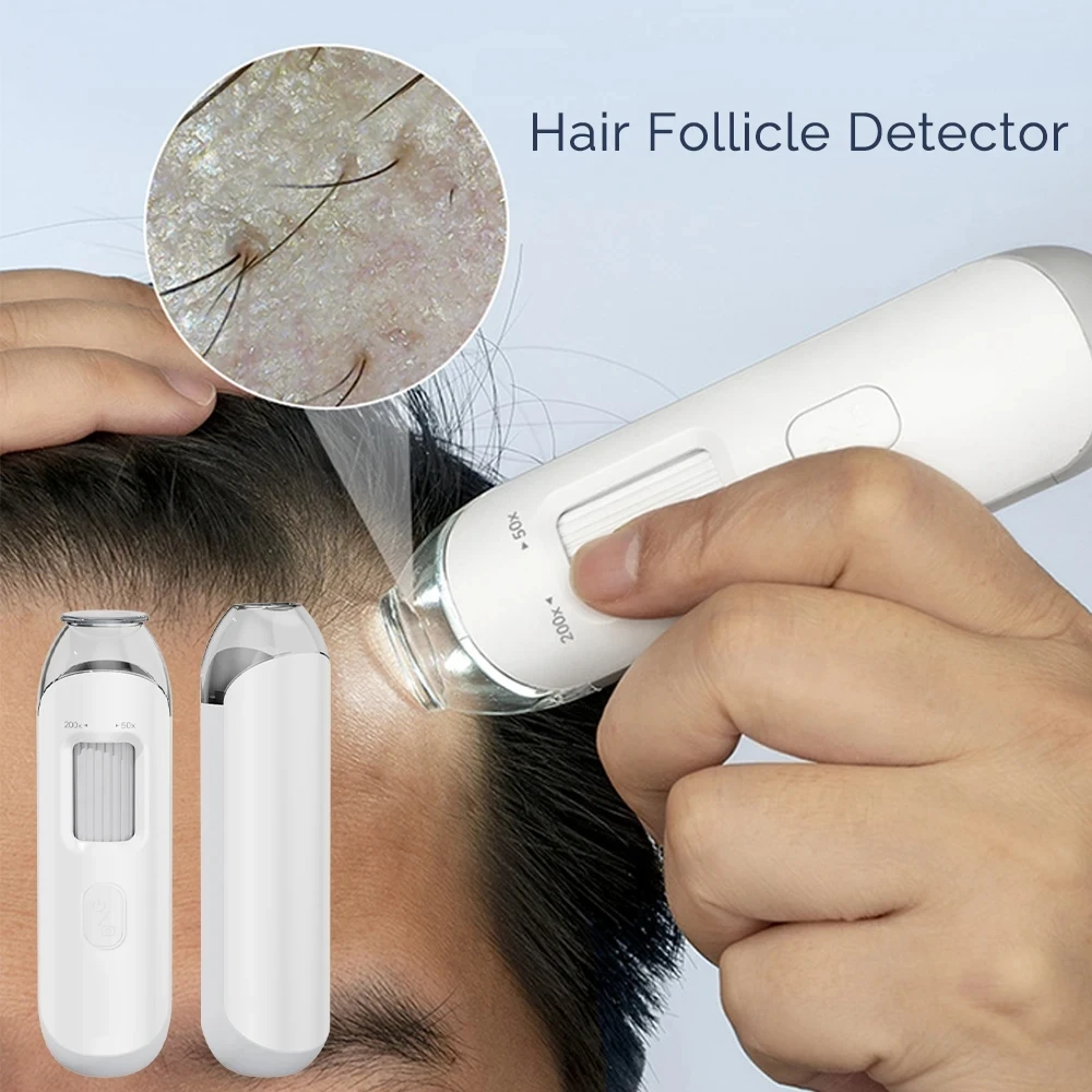 New 50X/200X Hair Follicles Scalp Detector Dermatoscope Tester Skin Analyzer Machine For Scalp Diagnostic Skin Care Tools
