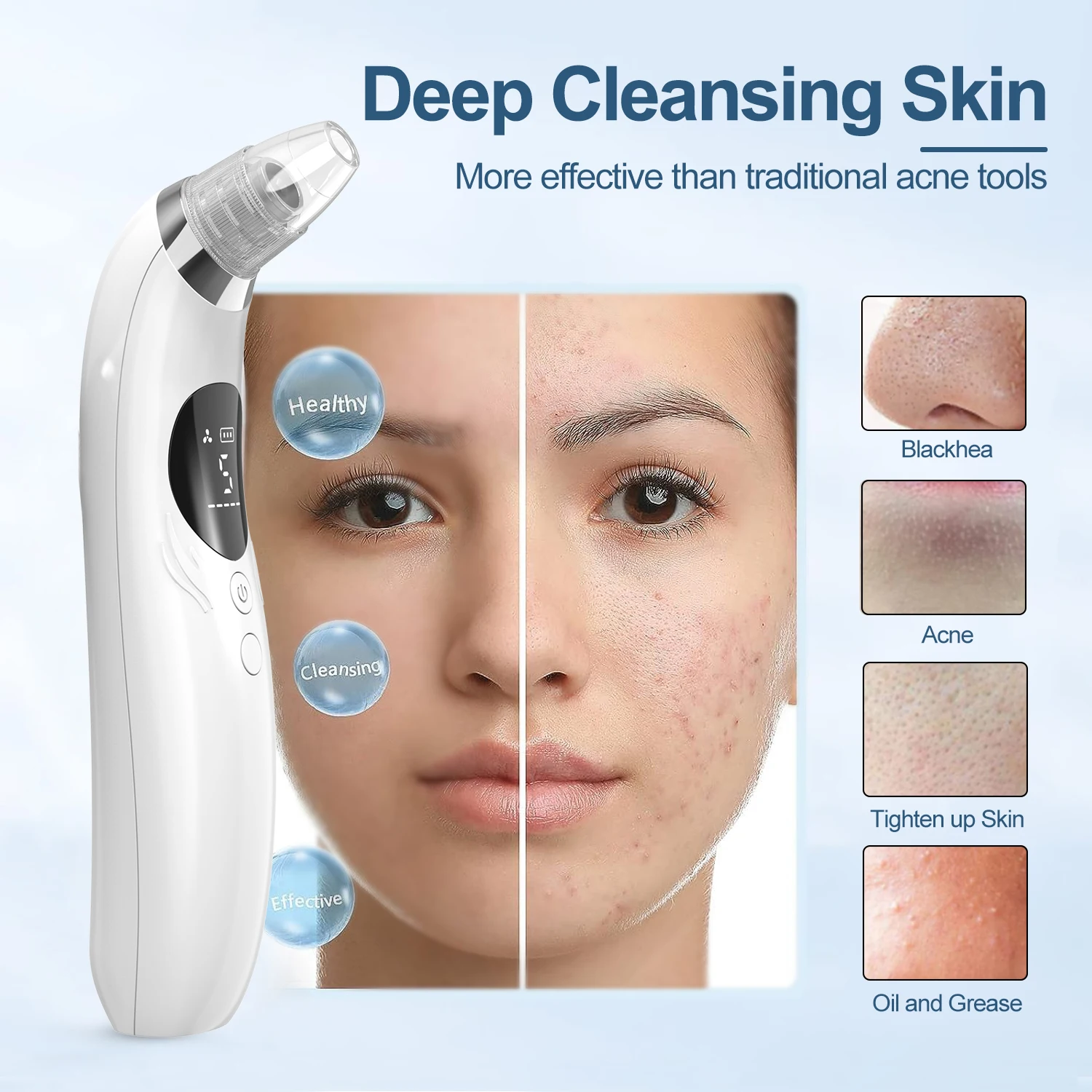 Hot Sale Blackhead remover  Face cleaner Face scrubber Black dots Type-C Charging 5 Probes & Levels Face lifting machine