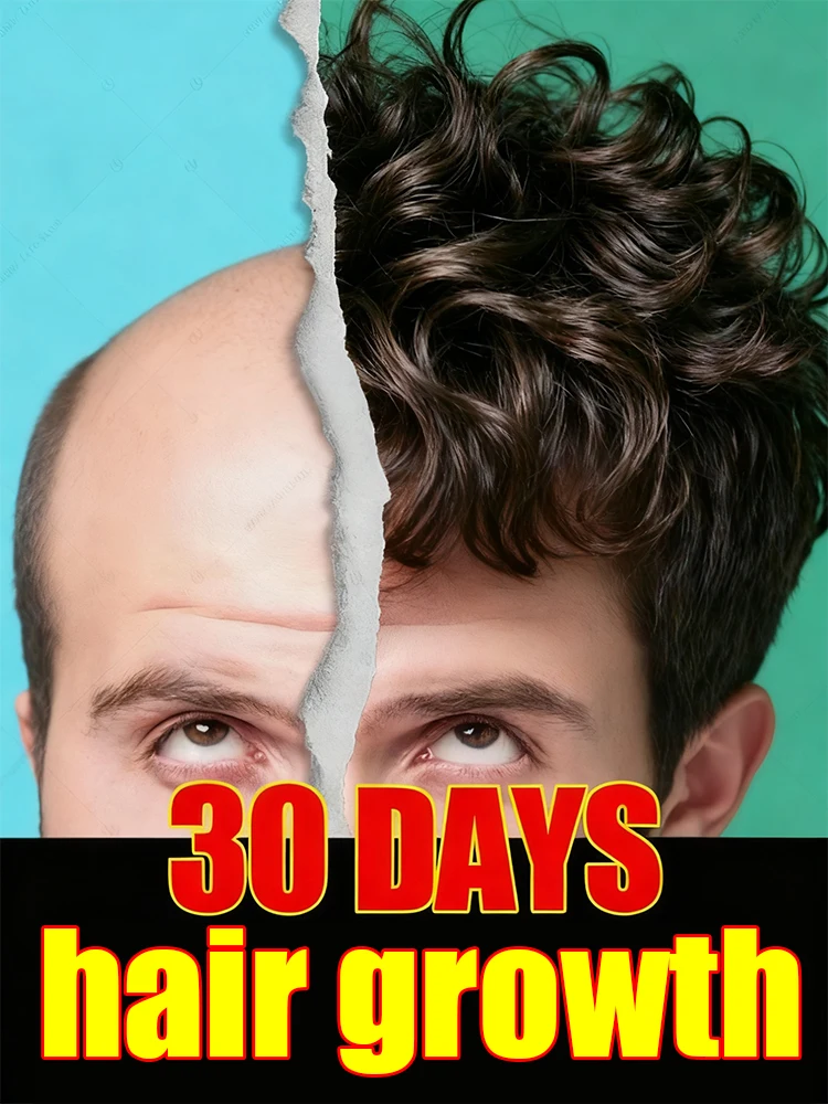 

Сохранитель облысения, легко восстанавливает густые черные волосы, укрепляет вашу уверенность и возврат вершины штампов.