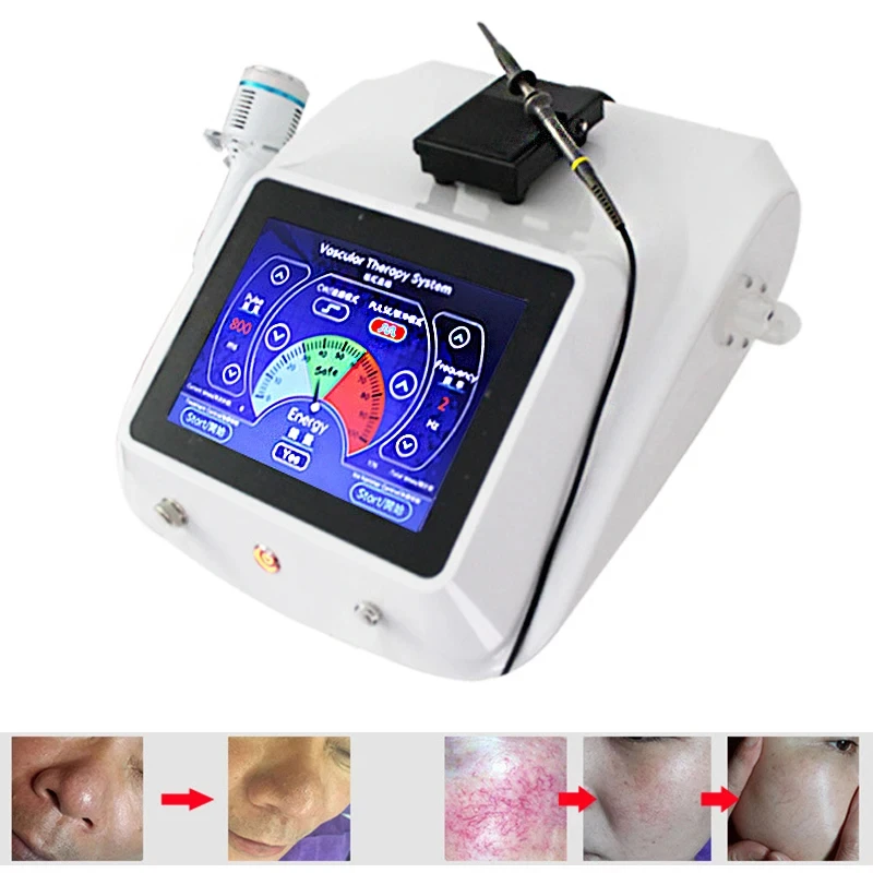 

980 Red Blood Vessel Spots Vascular Removal Beauty Equipment High Frequency Needle RF Spider Veins Removal Anti Redness Machine