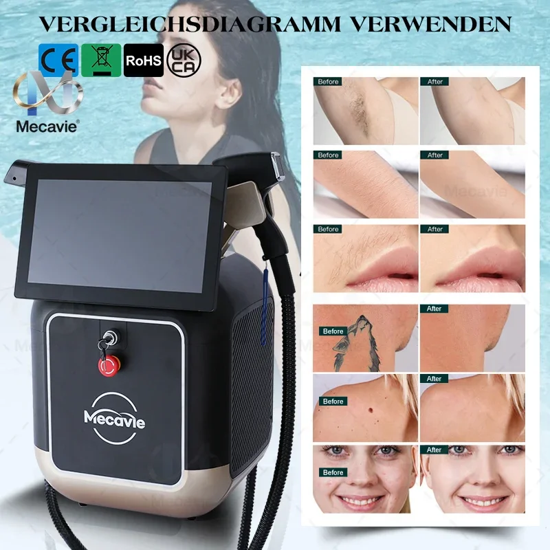 

Новейшая модернизированная лазерная установка 2-в-1 Soprano Titanium Ice Platinum с диодами 755, 808, 940, 1064 нм и 4 длинами волн, 4000 Вт, для безболезненного удаления волос