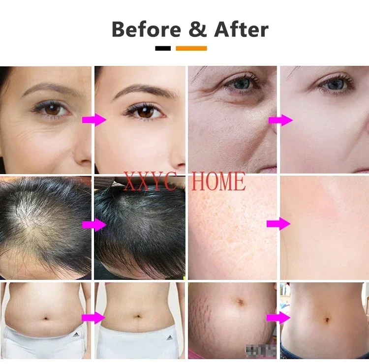 Инъекционный пистолет Co2 Carboxy Therapy для глаз с газовым баллоном Co2 C2p