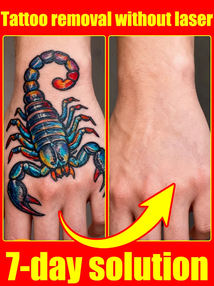 色付きの永久メイクタトゥー除去-タトゥーの迅速な除去