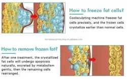 Tragbare, effektive Cyro Crioterapia 360-Kryolipolyse, kühles Abnehmen, Gewichtsverlust, Bildhauerei, Fettgefrieren, Gürtel, Kryotherapie
