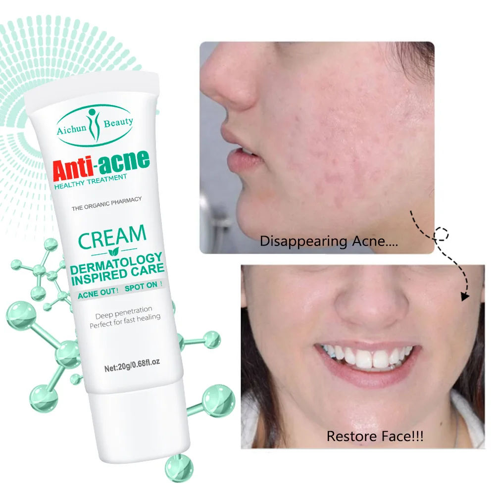 Salicylic acid face cream moisturizes tender and smooth skin brightens skin tone dispels acne and shrinks pores