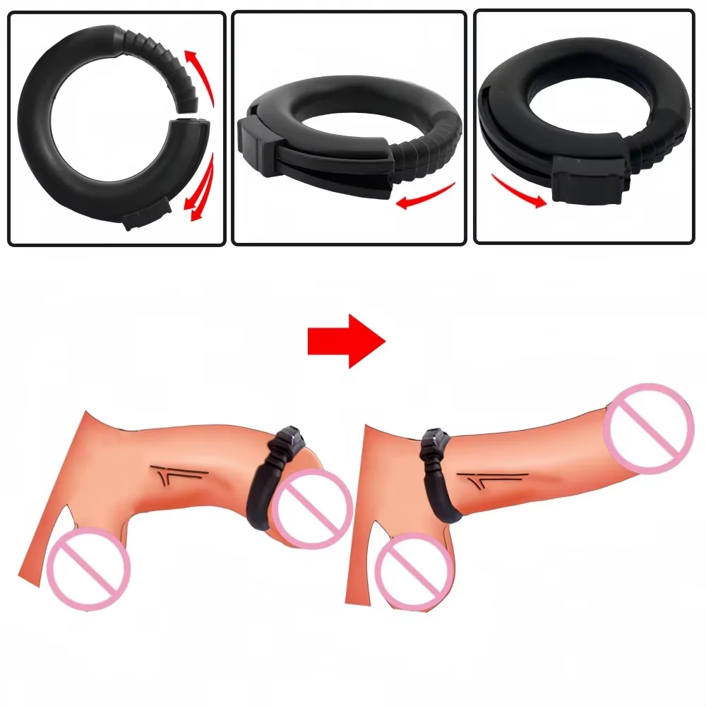Penis Erection Ring Penis Circumcision Corrector Delayed Ejaculation Locking Cock Ring Adjustable Silicone Adult Products - view 5