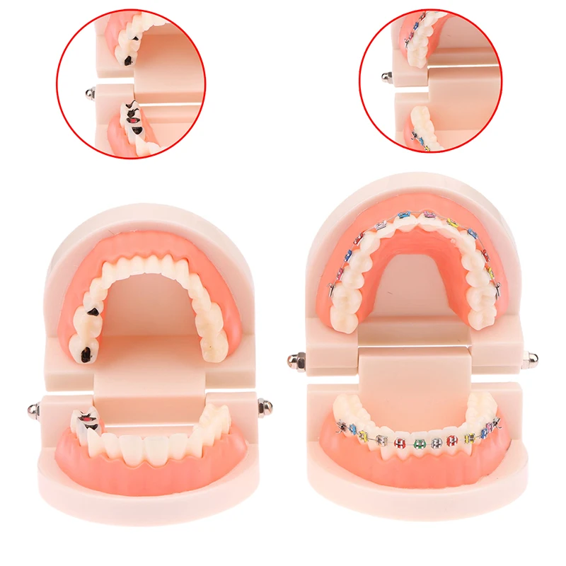 Dental Teaching Model Standard Dental Orthodontic Teeth Model Dentist Lab Tooth Model Teaching Tools