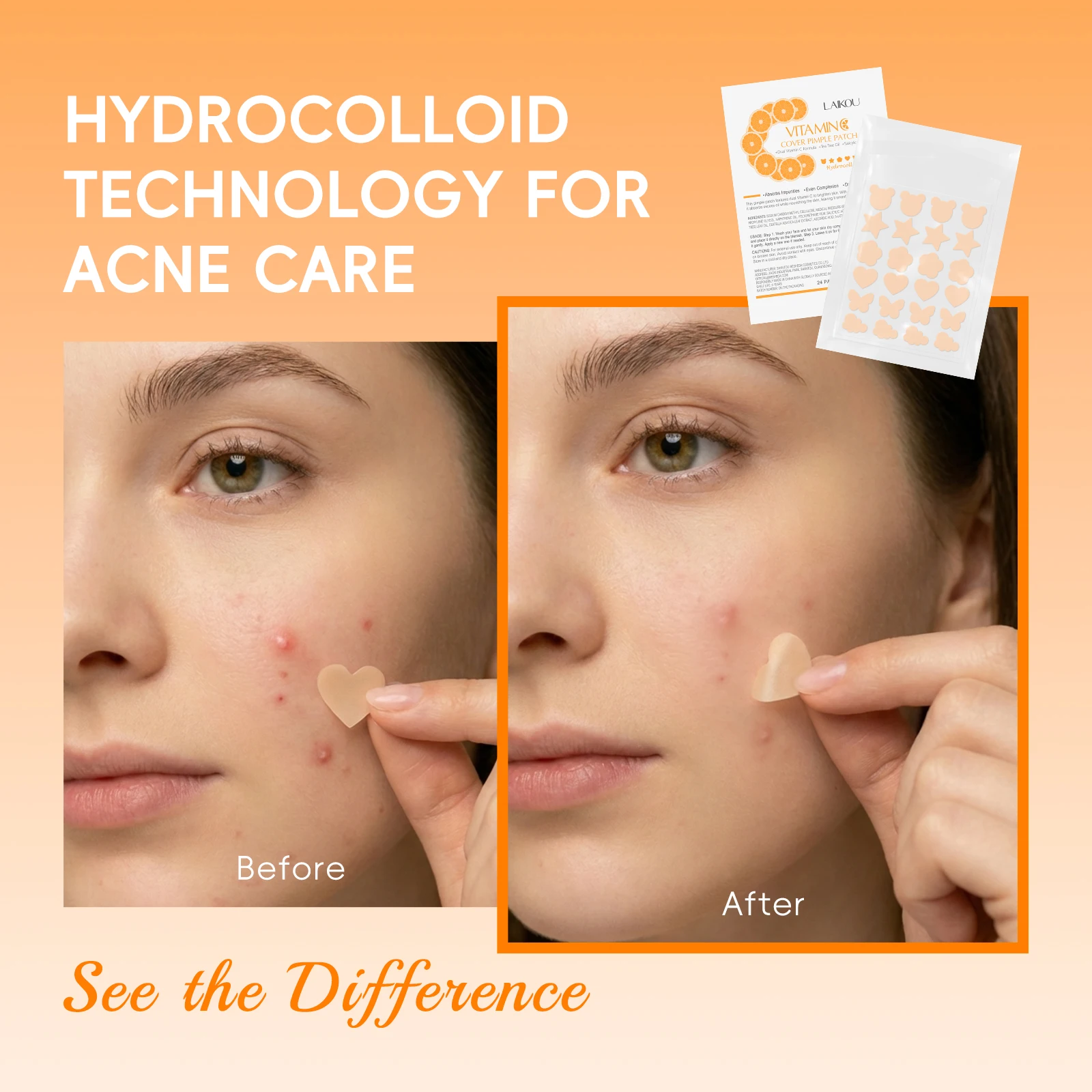 LAIKOU Vitamin C Cover Pimple Patch 24 Patches Absorbs Impurities Evens Complexion Day & Night Use Acne Patches