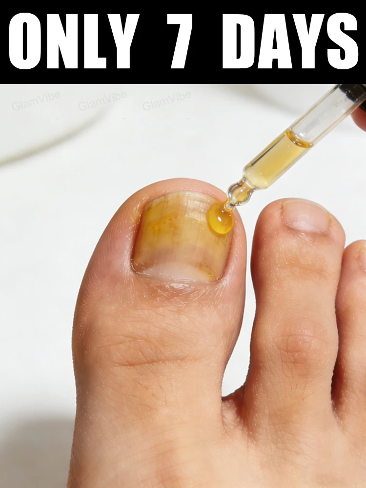 

2026 Limited Offer! Free Shipping! Tea Tree Nail Solution 10ml